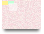 Coledocolitiasis